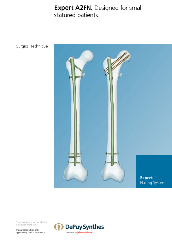 FRNADVANCED Femoral Recon Nailing System  Products  DePuy Synthes
